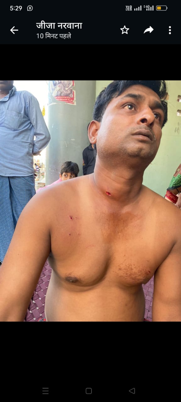 काकोरी के नरौना गांव मैं फूल तोड़ने गए किसान के ऊपर तेंदुए ने किया हमला।
